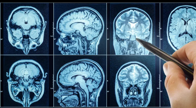 Enhanced Mental Clarity