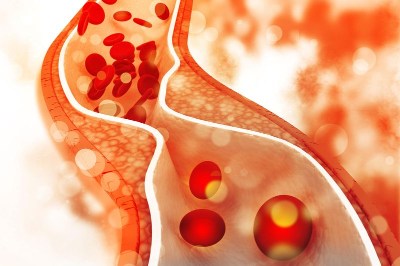 May Lower Cholesterol