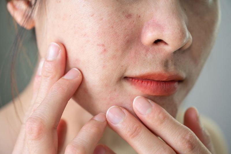 Skin Health