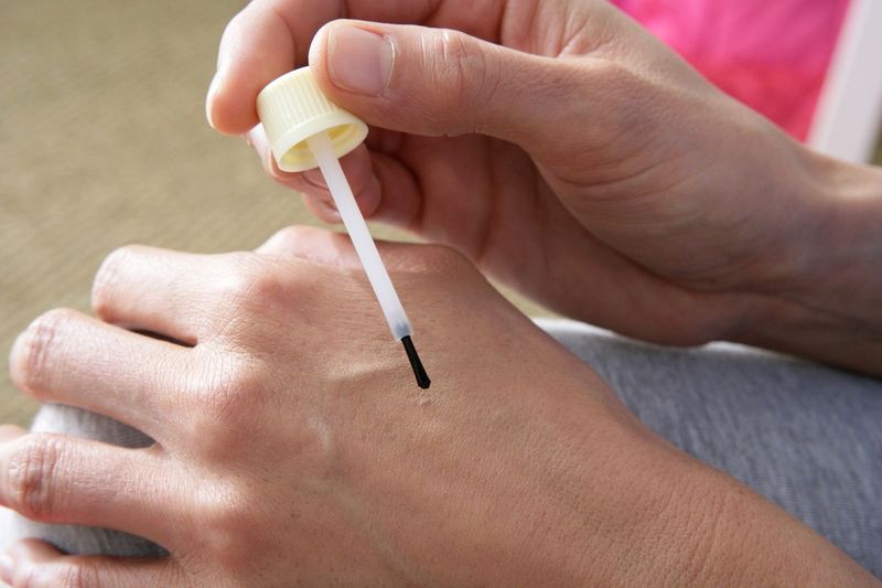 Wart Remover